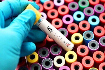 ایران در مسیر مهار HIV؛ درمان رایگان شد، انتقال نزدیک صفر ایران در مسیر مهار HIV؛ درمان رایگان شد، انتقال نزدیک صفر