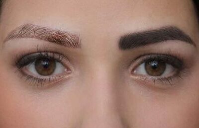 عوارض پاک کردن تاتو ابرو با لیزر {۵ عوارض مهم و تجربی}