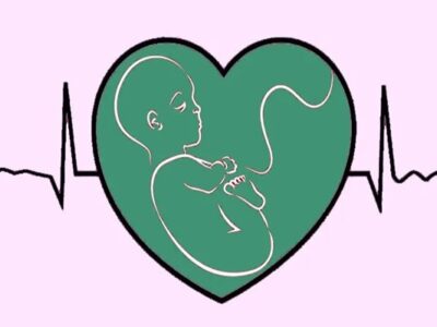 رفلاکس بارداری؛ از فشار رحم تا تغییرات هورمونی