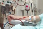 روش ساده خنثی کردن «مه مغزی» در بیماران شیمی درمانی